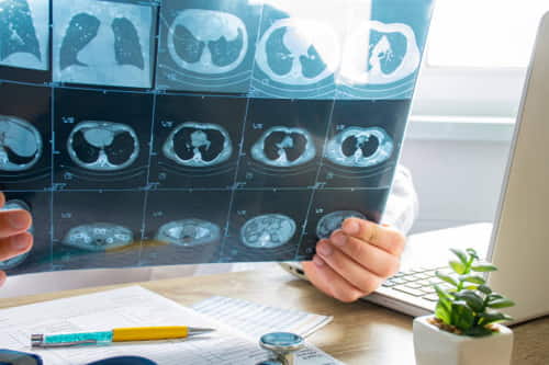 Razones por las que se realiza el examen una tomografía abdominal
