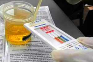 Antidoping 5 elementos en Salud Digna – Precios, laboratorios, resultados, requisitos