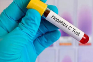 Prueba de hepatitis en Salud Digna – Precios, laboratorios, resultados, requisitos